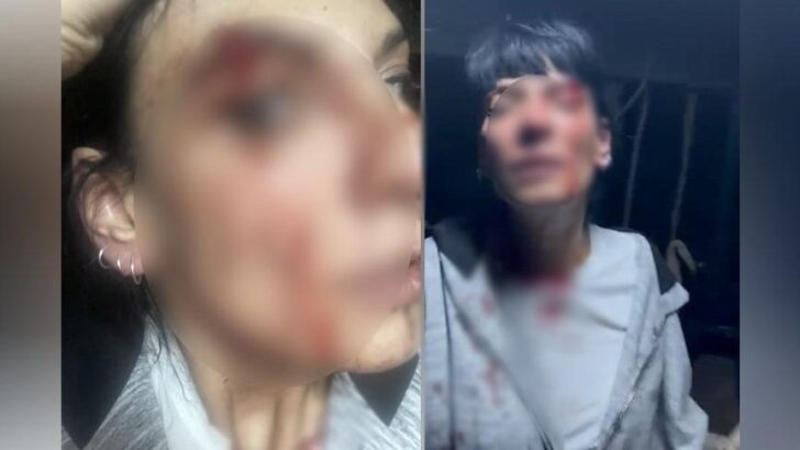 Esenyurt’ta kadına şiddet: 2 kişi tutuklandı