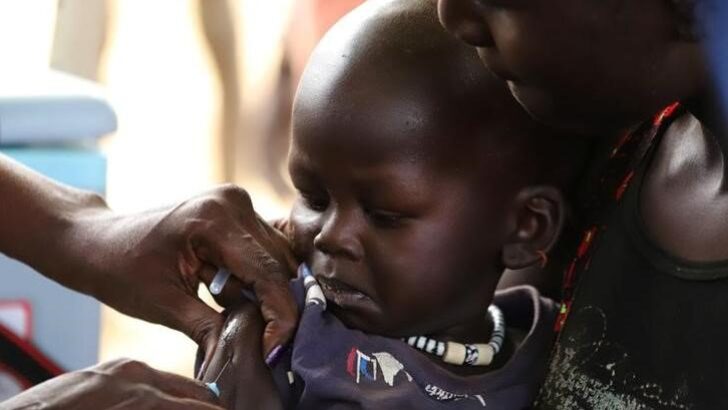 Zimbabve’de 157 çocuk kızamık salgınında hayatını kaybetti