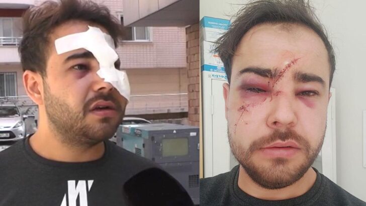 İkinci Onur Şener vakası! İstek parçayı çalmadı diye…