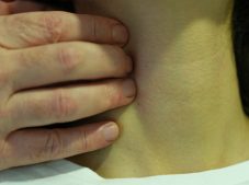 Boynunuzdaki şişliği göz ardı etmeyin! Profesör uyardı: ‘Ciddi bir hastalığın habercisi olabilir’