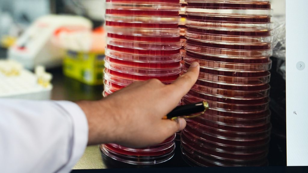 Uzayda göz sağlığına Türk katkısı!